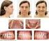 ODO0028 CLÍNICA ODONTOLÓGICA II: Clínica Adulto II Dentística, Periodontia e Endodontia