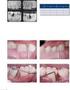 A PARTICIPAÇÃO DAS CÉLULAS T HELPER NA PERIODONTITE CRÔNICA T helper cells participation on chronic periodontitis?