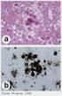 PRÍONS E AS ENCEFALOPATIAS ESPONGIFORMES TRANSMISSÍVEIS