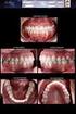 Avaliação da necessidade de radiografias intra-orais antes e após tratamentos odontológicos