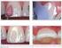 Fotografia Digital em Ortodontia Parte IV Sugestão de Equipamento