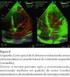 Avaliação do ventrículo direito nos pacientes com hipertensão pulmonar