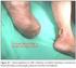 Autocuidado nos fatores de risco da ulceração em pés diabéticos: estudo transversal