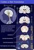 Estimulação cerebral para o tratamento de dor neuropática