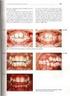 Relation between ceceio anterior, craniofacial growth and non-nourish sucking in from 3 and 7 year-old childrem