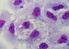 Formação in vitro de biofilme por Pseudomonas aeruginosa e Staphylococcus aureus na superfície de canetas odontológicas de alta rotação