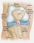 LESÃO DO LIGAMENTO CRUZADO ANTERIOR: APRESENTAÇÃO CLÍNICA, DIAGNÓSTICO E TRATAMENTO