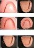 Avaliação dimensional de moldes de hidrocolóide irreversível após desinfecção