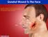 Treatment of facial wounds