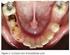 Variabilidade na detecção e tratamento da cárie dentária in vitro por acadêmicos: a importância do processo ensino-aprendizagem