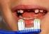 Estudo da cronologia da erupção dental decídua das crianças atendidas nas clínicas do curso de Odontologia da Univali
