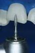 Reabilitação estética em dente anterior fraturado através da colagem de fragmento autógeno: relato de caso clínico