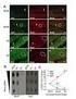 Antibodies anti-infectious Bursal Disease virus and viral genome detection in broilers and chickens backyard at Bahia s poultry production area