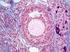 Sincronização folicular e vascularização do folículo dominante em novilhas mestiças tratadas com estradiol*