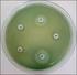 ANTIMICROBIAL SENSITIVITY PROFILE OF Pseudomonas aeruginosa ISOLATED FROM INTENSIVE TREATMENT UNIT PATIENTS OF A PUBLIC HOSPITAL IN BRASILIA