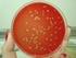 Infeção Perinatal por Streptococcus do Grupo B: Prevenção