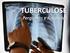 Tuberculose. Definição Enfermidade infecto-contagiosa evolução crônica lesões de aspecto nodular - linfonodos e pulmão Diversos animais Zoonose