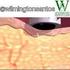 Efeitos da ultracavitação no tecido adiposo de coelhos Ultra-cavitation effect in adipose tissue of rabbits