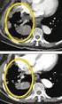 Modelos Biológicos no Cancro da Próstata