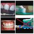 Avaliação da Presença de Defeitos de Esmalte pelo Índice Visual DDE Modificado e por Aparelho de Fluorescência a Laser (DIAGNOdent)