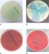 Comparação da atividade antimicrobiana de soluções de peróxido de hidrogênio e malva sobre candida albicans