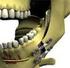 Alterações no perfil dos lábios de pacientes submetidos a avanços maxilares em cirurgia ortognática do tipo Le Fort I*