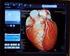 Acurácia da Tomografia Computadorizada de Múltiplos Detectores no Diagnóstico da Doença Arterial Coronariana: revisão sistemática