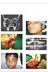 Epidemiology of oral and maxillofacial injuries by aggression in Aracaju/SE