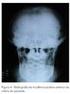 ASPECTOS CLÍNICOS, RADIOGRÁFICOS E MICROBIANOS DE UMA FAMÍLIA COM EXPRESSIVA PREVALÊNCIA DE DOENÇA PERIODONTAL