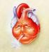 Insuficiência cardíaca descompensada na unidade de emergência de hospital especializado em cardiologia