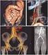 PROCESSAMENTO DE IMAGENS EM RADIODIAGNÓSTICOS