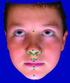 ANTHROPOMETRICAL OROFACIAL MEASUREMENT IN CHILDREN FROM THREE TO FIVE YEARS OLD