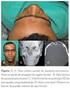 Etiologia e incidência das fraturas faciais: estudo prospectivo de 108 pacientes