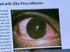 Achados oculares em pacientes com mais de 99 anos