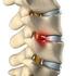 INSTRUÇÕES DE USO. IMPLANTE PARA COLUNA VERTEBRAL O.I.C. (Implante para Coluna)