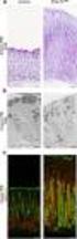 Ultrastructural characteristics of the intestinal mucosa of newborn calves fed in the second meal with colostrum enriched with IGF-I and IgG