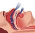 Quadro clínico: reconhecimento do paciente com apneia obstrutiva do sono Clinical presentation: recognizing the patient with obstructive sleep apnea