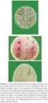Atividade antibacteriana in vitro de géis com diferentes concentrações de papaína