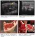 CARACTERÍSTICAS DA CARCAÇA E QUALIDADE DA CARNE DE BOVINOS TERMINADOS EM SISTEMA DE INTEGRAÇÃO LAVOURA-PECUÁRIA RESUMO