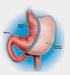 Efeitos da Cirurgia Bariátrica na Estrutura e na Função do Ventrículo Esquerdo