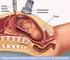 Gestações com artéria umbilical única isolada: frequência de restrição do crescimento fetal