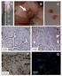 Apoptosis and cellular proliferation in endometriosis: the state of the art Apoptose e proliferação celular na endometriose: estado da arte