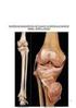 Caracterização por estudo anátomo-radiográfico da posição patelar em pacientes portadores de dor no joelho