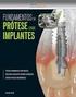 Materiais reembasadores: estudo da deformação inicial, permanente e porosidade. Soft liners: study of initial and permanent deformation and porosity