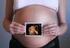 Avaliação da vitalidade fetal por meio da Ultrassonografia com Doppler. A avaliação fetal difere de acordo com o local de insonação vascular?