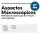 Aspectos Macroscópicos