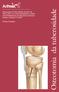Osteotomia da tuberosidade
