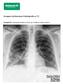 Imagem da Semana: Radiografia e TC. Imagem 01. Radiografia simples do tórax em incidência póstero-anterior.