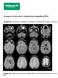 Imagem da Semana: Ressonância magnética (RM)