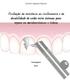 Avaliação da resistência stência ao cisalhamento e da durabilidade de união entre sistemas para reparo em metalocerâmicas e titânio